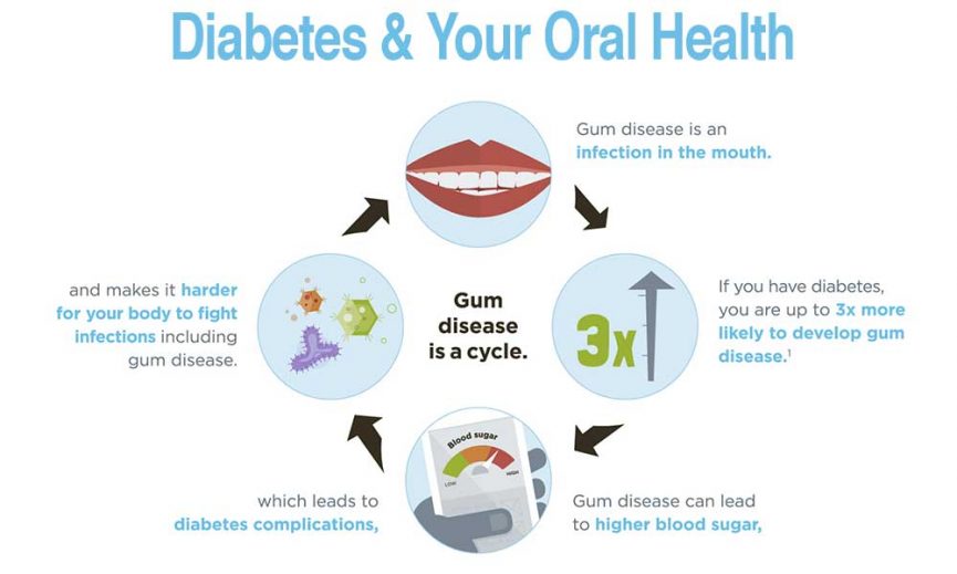 with diabetes problems oral McOmie   Dentistry and Health Your Oral Diabetes Family