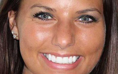 Ever Wonder How Teeth Whitening Works?