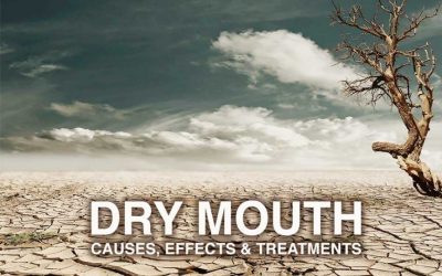 Dry Mouth (Xerostomia) Causes, Effects and Treatments
