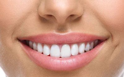 Teeth Replacement Alternatives To Dental Implants